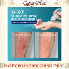 Gel Làm Dịu Và Hỗ Trợ Giảm Ngứa Cho Da Chàm, Viêm Da Cơ Địa 59ml