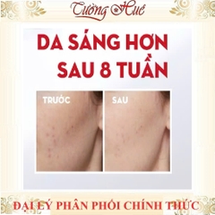 [HàngCóTem] Kem Olay Luminous Niacinmamide Dưỡng Ẩm Làm Mờ Thâm Nám Và Đốm Nâu 50g - Có Lựa Chọn