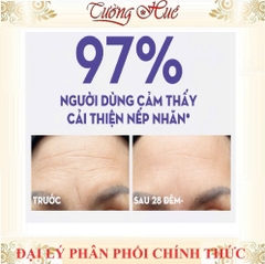 [HàngCóTem] Olay Tinh Chất Serum Dưỡng Da 30ml - Có Lựa Chọn
