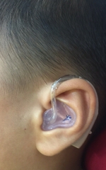 children-use-bte-hearing-aid