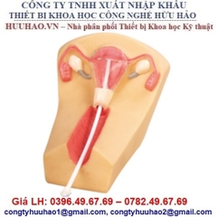 MÔ HÌNH THỰC HÀNH ĐẶT VÒNG TRÁNH THAI GD/F5N