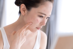 Mụn trứng cá: Phân loại, nguyên nhân và cách để giảm thiểu?