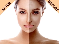 Top 10 Kem chống nắng & phục hồi sau đi nắng tốt nhất [Hot nhất 2018]