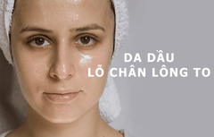 Review các loại kem chống nắng cho da dầu mụn tốt nhất 2022