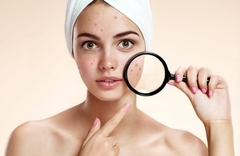 Dùng sữa rửa mặt bị nổi mụn nguyên nhân do đâu?