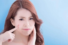 Những nguyên nhân gây mụn và cách chăm sóc da mụn hiệu quả