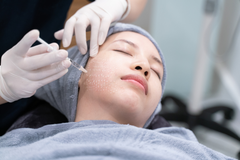 Meso là gì? Lý do tiêm Meso đang là trào lưu làm đẹp hot nhất hiện nay?