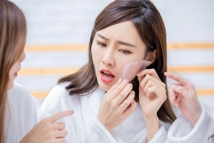 Vì Sao Da Tiết Nhiều Dầu Vào Mùa Hè?