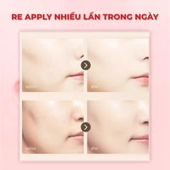 Sáp chống nắng Dermablock Mild Sun Stick SPF50+