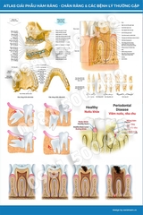 Tranh Atlas giải phẫu hàm răng - chân răng và các bệnh lý thường gặp