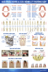 Tranh giải phẫu răng & các bệnh lý thường gặp