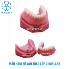 Hàm tư vấn tháo lắp 2 implant