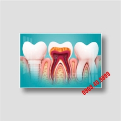 Tranh nha khoa 3D thiết kế hiện đại mới - MS12