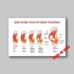 Tranh 