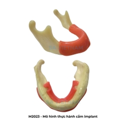 Mô hình thực hành cắm ghép implant, nâng xoang trong Nha khoa