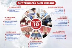 Tranh Quy trình cấy ghép implant Nha khoa