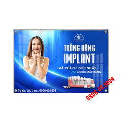 Tranh Implant nha khoa - MS17
