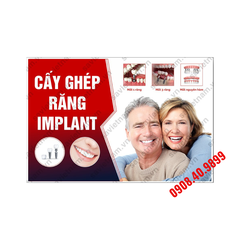 Tranh Implant nha khoa- MS21