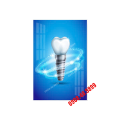 Tranh Implant nha khoa- MS28