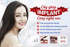 Tranh cấy ghép Implant công nghệ cao