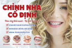 Tranh chỉnh nha cố định