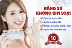 Tranh Răng sứ không kim loại