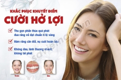 Tranh khắc phục khuyết điểm cười hở lợi