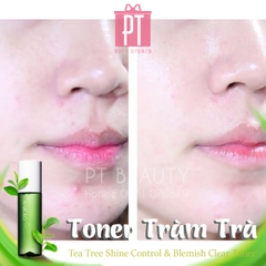 Nước hoa hồng Tràm trà - Naruko Tea tree Shine Cotrol & Blemish Clear Toner 150ml