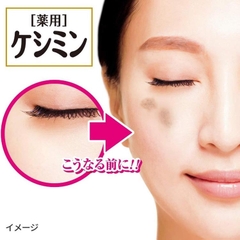 Kem ngừa nám Kobayashi 30g - hàng Nhật nội địa