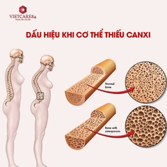 7 dấu hiệu khi cơ thể thiếu canxi