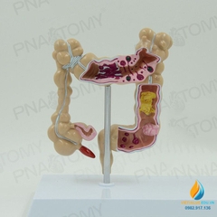 Mô hình giải phẫu ruột già của con người, mô hình ruột già, nhựa PVC cao cấp