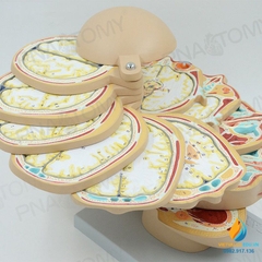 Mô hình chụp cắt lớp cắt ngang não, CTMRI chụp cộng hưởng từ thần kinh học