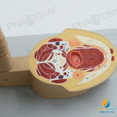 Mô hình chụp cắt lớp cắt ngang não, CTMRI chụp cộng hưởng từ thần kinh học