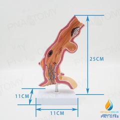 Mô hình giải phẫu bệnh lý thực quản ở người, nhựa PVC cao cấp