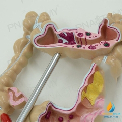 Mô hình giải phẫu ruột già của con người, mô hình ruột già, nhựa PVC cao cấp