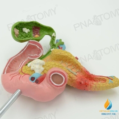 Mô hình giải phẫu tuyến tụy, tá tràng và túi mật, nhựa PVC cao cấp