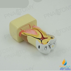 Mô hình giải phẫu bệnh lý sâu răng, mô hình cấu trúc sâu răng, nhựa PVC cao cấp