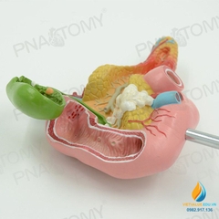 Mô hình giải phẫu tuyến tụy, tá tràng và túi mật, nhựa PVC cao cấp