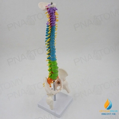 Mô hình giải phẫu cột xương sống uốn cong 45cm, đốt sống trật khớp
