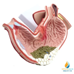 Mô hình giải phẫu cấu trúc dạ dày con người