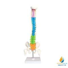 Mô hình giải phẫu cột xương sống uốn cong 45cm, đốt sống trật khớp