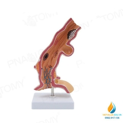 Mô hình giải phẫu bệnh lý thực quản ở người, nhựa PVC cao cấp