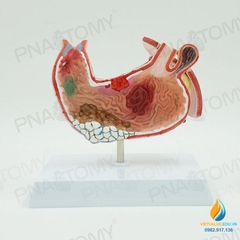Mô hình giải phẫu cấu trúc dạ dày con người
