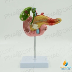 Mô hình giải phẫu tuyến tụy, tá tràng và túi mật, nhựa PVC cao cấp