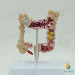 Mô hình giải phẫu ruột già của con người, mô hình ruột già, nhựa PVC cao cấp