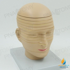 Mô hình chụp cắt lớp cắt ngang não, CTMRI chụp cộng hưởng từ thần kinh học