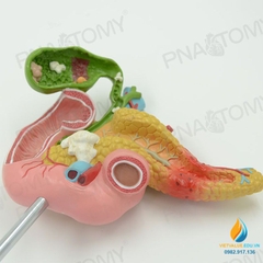 Mô hình giải phẫu tuyến tụy, tá tràng và túi mật, nhựa PVC cao cấp