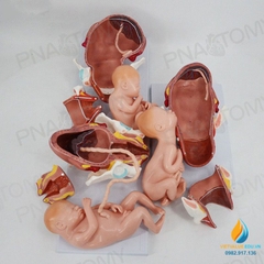 Mô hình giải phẫu phôi thai nữ sinh đủ tháng