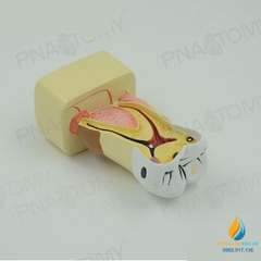 Mô hình giải phẫu bệnh lý sâu răng, mô hình cấu trúc sâu răng, nhựa PVC cao cấp