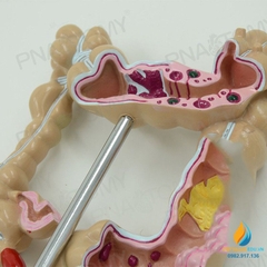 Mô hình giải phẫu ruột già của con người, mô hình ruột già, nhựa PVC cao cấp
